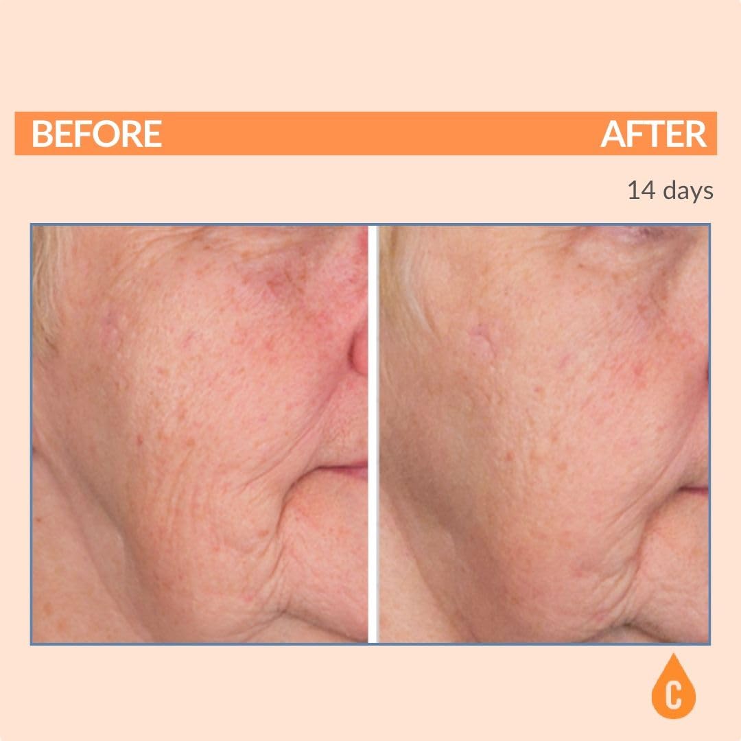 Serious Skincare Vitamin C Serum for Face, Anti-Aging Face Serum with Collagen, Vitamin E, Hydrating Skin Care for Brightening, Improve Appearance of Dark Spots - FENGGESTORE20