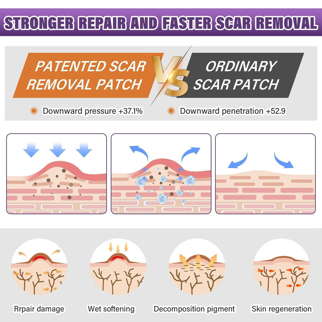 Silicone Scar Sheets,Silicone Scar Tape,Silicone Scar Removal Strips for Surgical,C-Section,Tummy Tuck,Keloid Scars - FENGGESTORE20