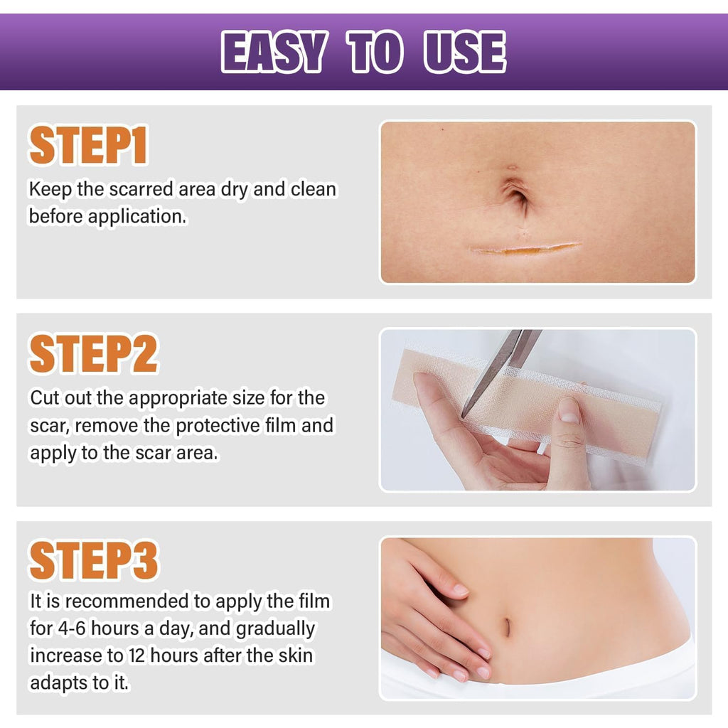 Silicone Scar Sheets,Silicone Scar Tape,Silicone Scar Removal Strips for Surgical,C-Section,Tummy Tuck,Keloid Scars - FENGGESTORE20