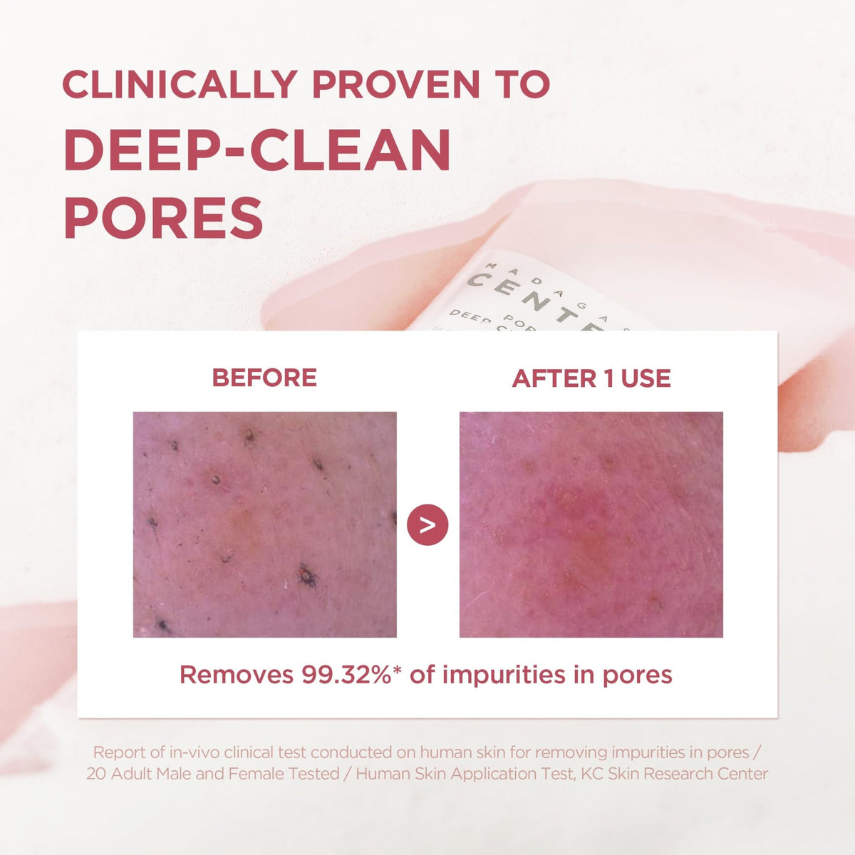 SKIN1004 Poremizing Deep Cleansing Foam, 4.23 fl.oz, 125ml, Makeup Remover, Korean Face Cleanser with Himalayan Pink Salt - FENGGESTORE20