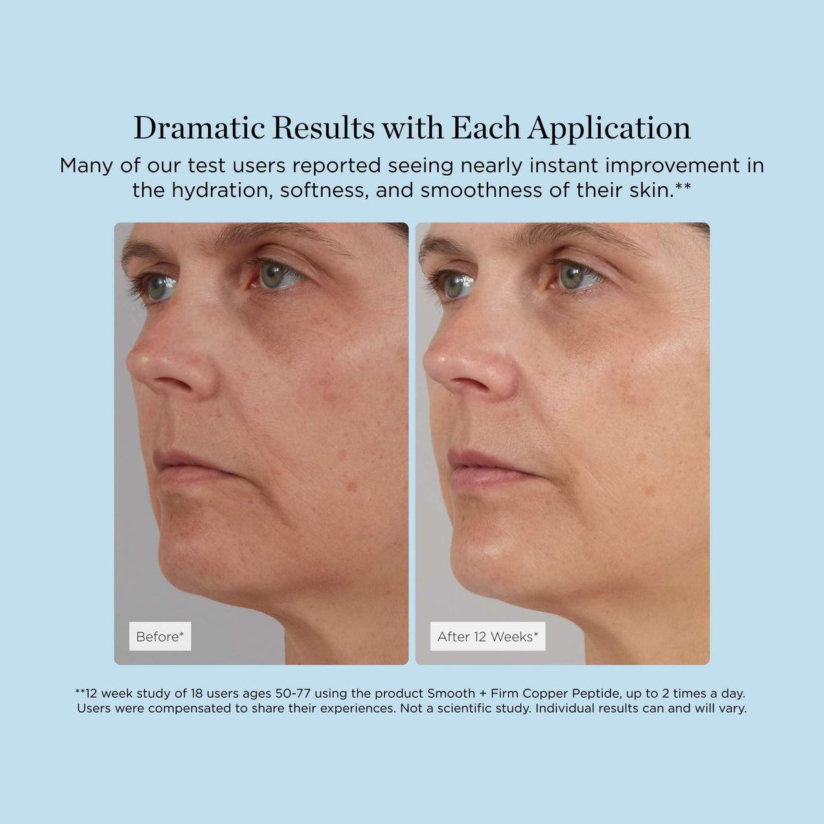 Smooth + Firm Copper Peptide Concentrate Serum for Aging Skin, Plumping Niacinamide for Tightening & Brightening, Helps Improve Elasticity, Hyperpigmentation & Dark Spots, Water Based, 1.18 Fl Oz - FENGGESTORE20