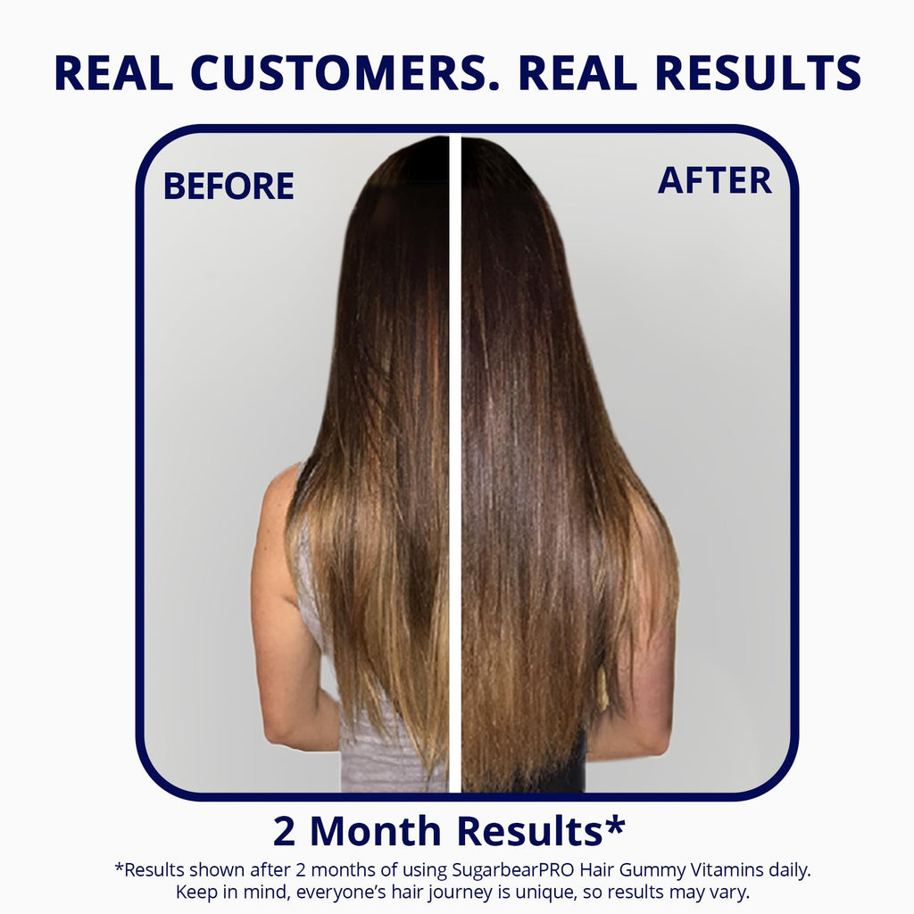 Sugarbear Hair Vitamin Gummy 2 Month Supply Extra Strength Biotin 6000mcg, Growth for Men & Women, Vegan Vitamin B12, MSM, Inositol, Omega 3, Elderberry, Certified Kosher, Halal, Cruelty-Free - FENGGESTORE20