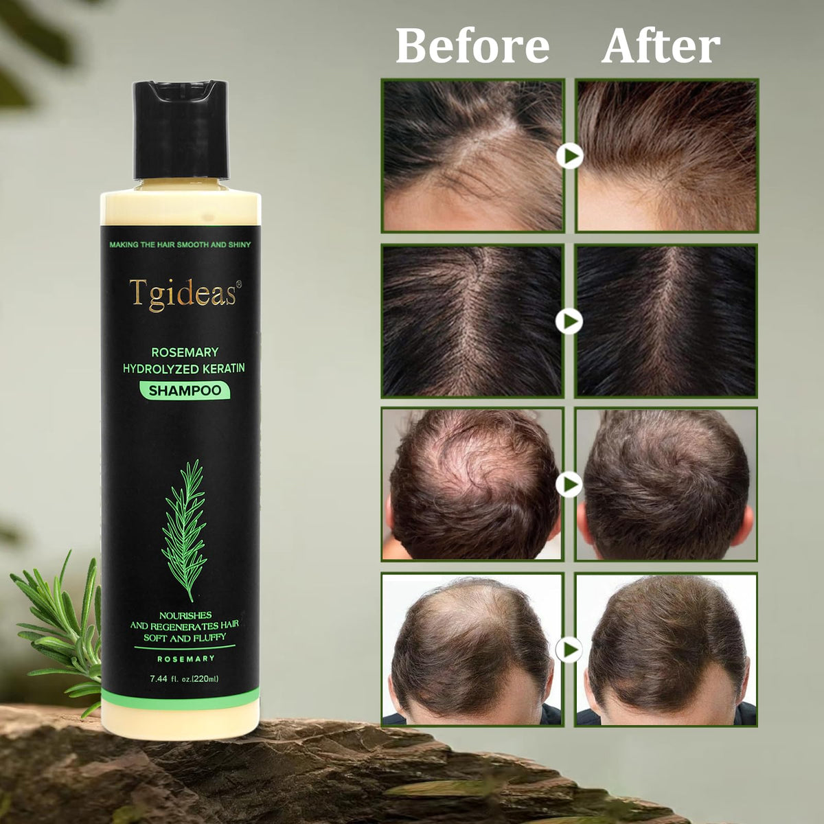 Tgideas Organic Rosemary Hair Growth Shampoo for Women and Men-Natural Thickening & Strengthening Shampoo with Hydrolyzed Keratin - FENGGESTORE20