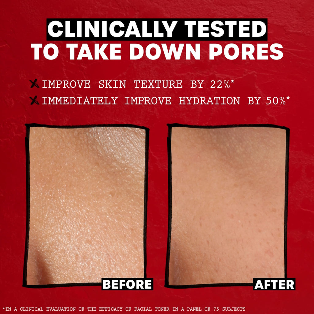 THAYERS Alcohol-Free Rose Petal Witch Hazel Facial Toner for Glowing Skin, Soothing - FENGGESTORE20