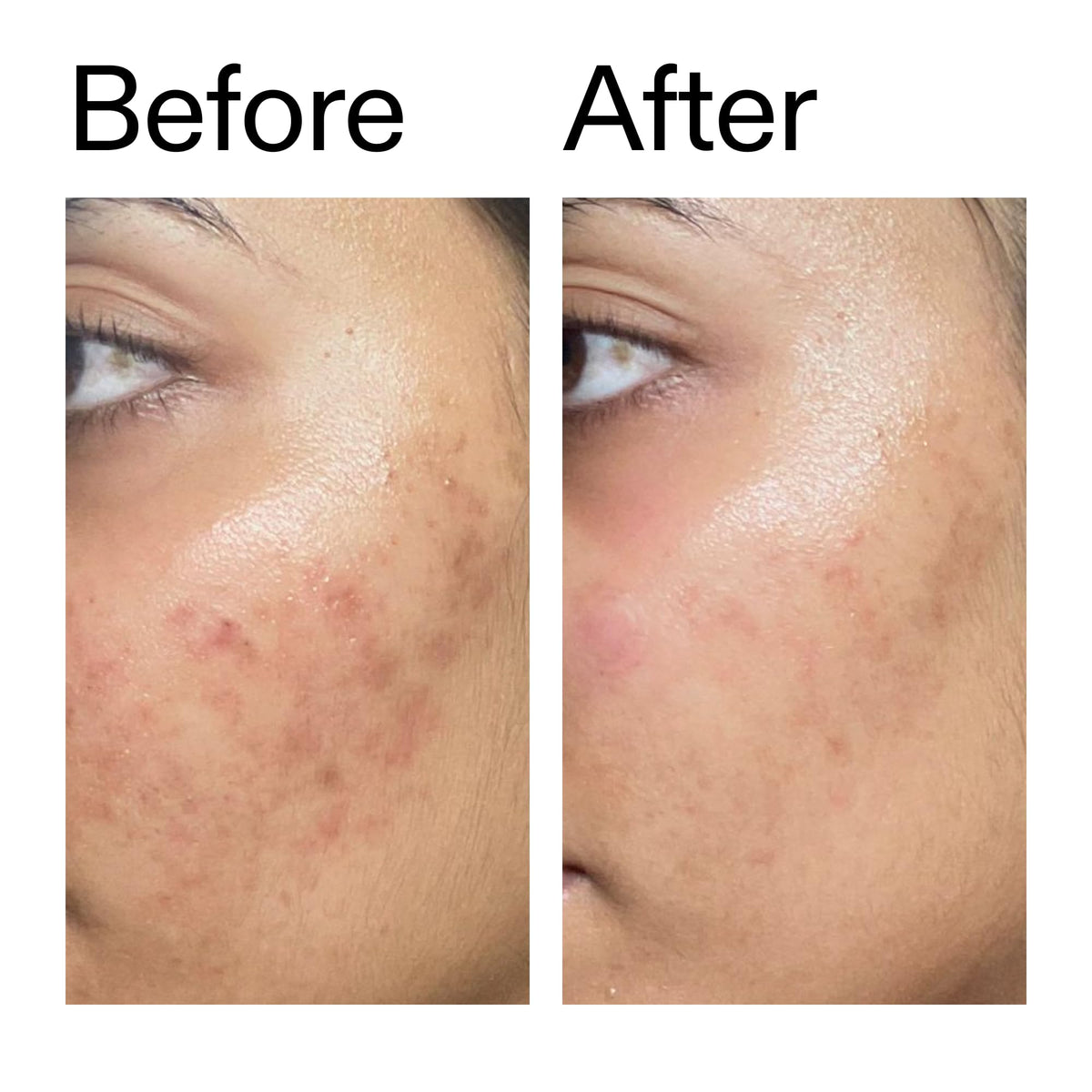 The INKEY List Ectoin Hydro-Barrier Serum, Advanced Dual-Action Serum, Boosts Hydration, Builds Stronger Skin Barrier, Lightweight Texture - FENGGESTORE20