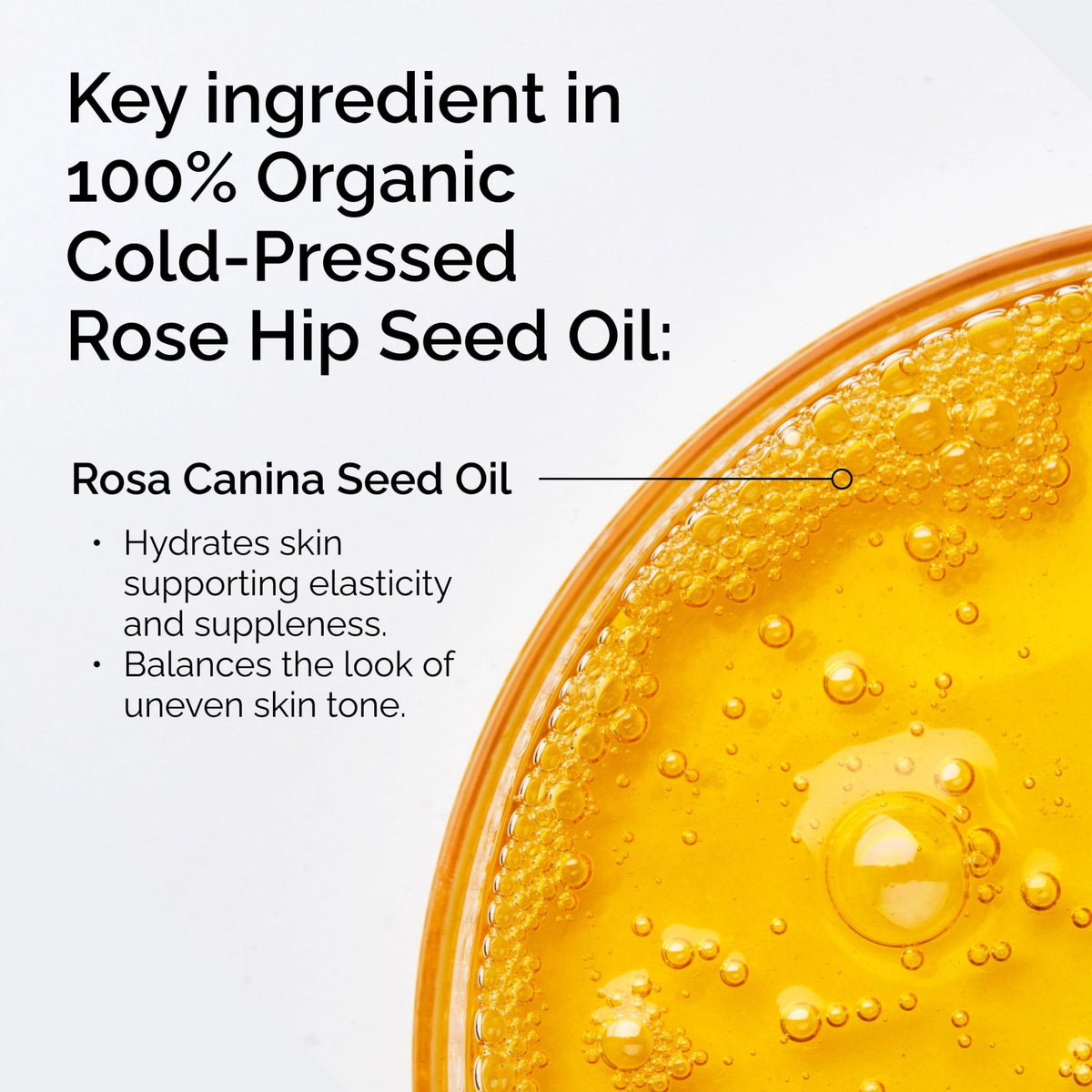 The Ordinary 100% Organic Cold-Pressed Rose Hip Seed Oil, Addresses Signs of Aging by Improving the Appearance - FENGGESTORE20