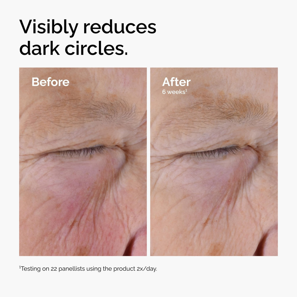 The Ordinary Caffeine Solution 5% + EGCG, Depuffing Eye Serum for Dark Circles and Tired Eyes, 1 Fl Oz - FENGGESTORE20