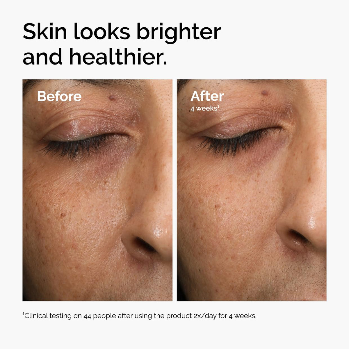 The Ordinary Multi-Antioxidant Radiance Serum, Vitamin C Serum For Face, Brighten & Protect Skin – Boosts Glow - FENGGESTORE20