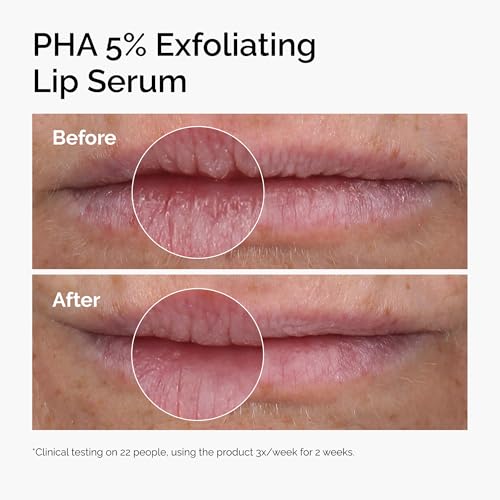 The Ordinary PHA 5% Exfoliating Lip Serum, Hydrating Overnight Lip Exfoliator Treatment, 0.5 Fl Oz - FENGGESTORE20