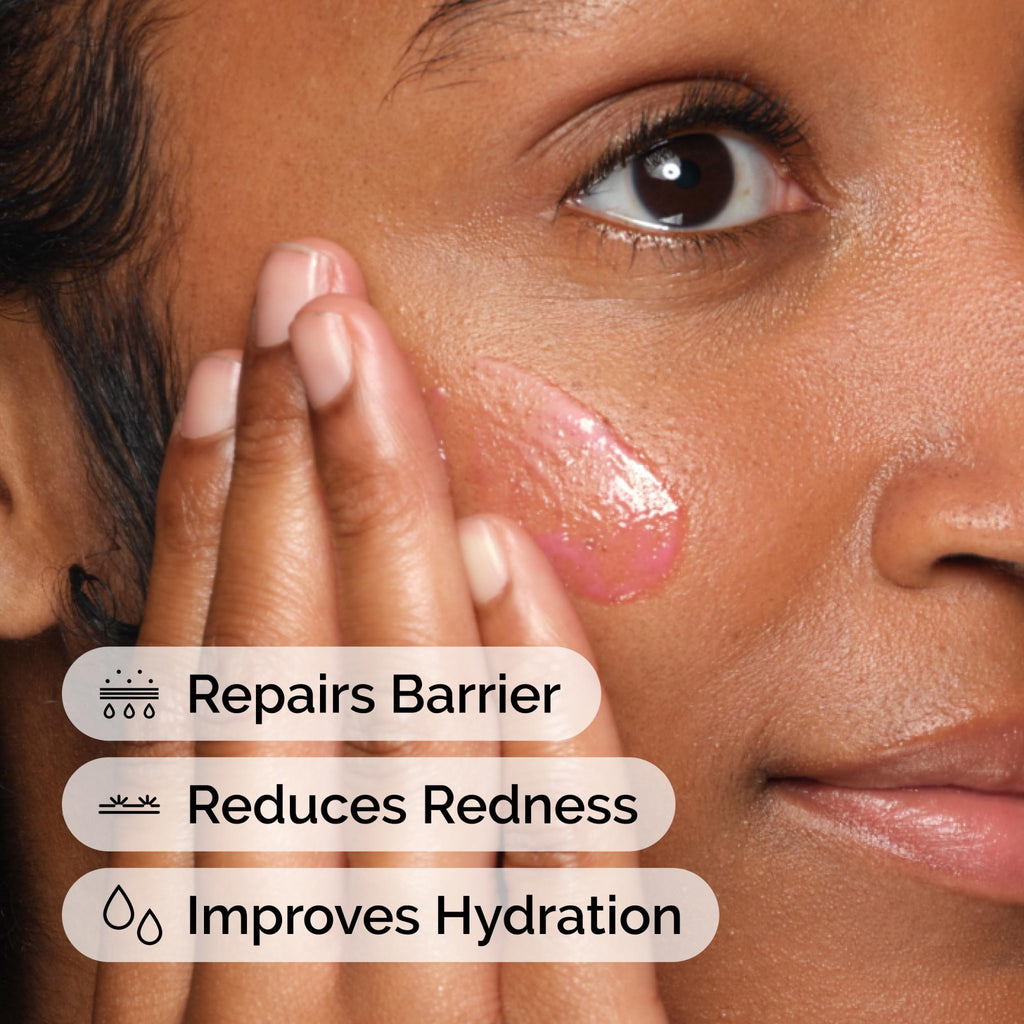 The Ordinary Soothing & Barrier Support Serum, Redness-Reducing & Hydrating Solution for Skin Barrier Recovery, 1 Fl Oz - FENGGESTORE20