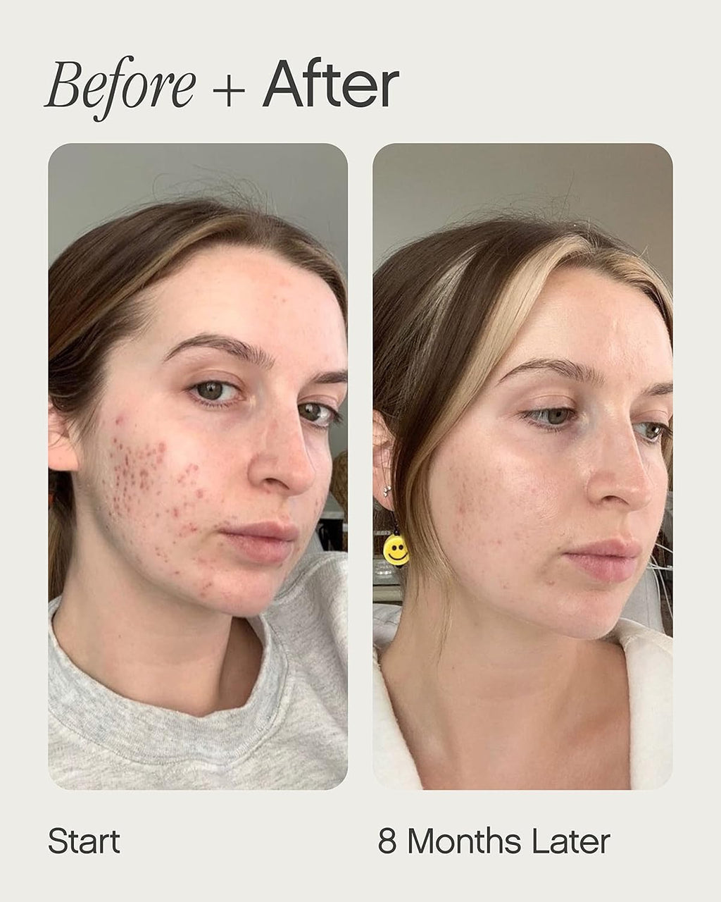 Topicals Faded Brightening and Clearing Serum | Reduces Discoloration, Post-Blemish Marks, Scars and Spots - FENGGESTORE20