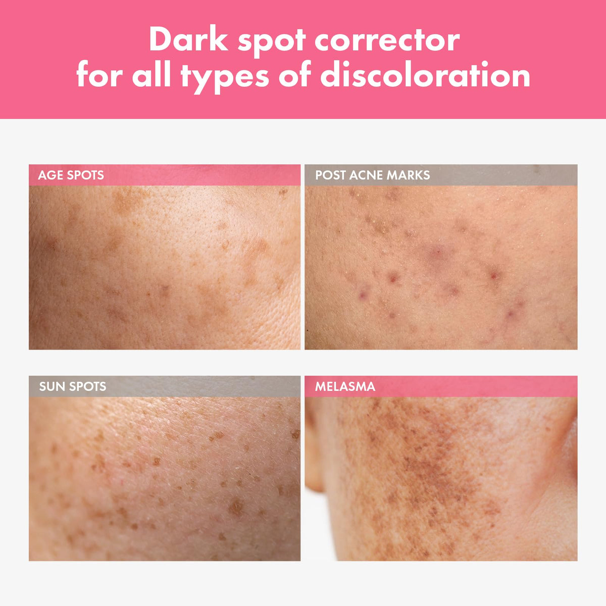 TOSOWOONG Arbutin 7% Intensive Spot Cream with 70,000ppm Arbutin, 3% Tranexamic Acid, 1% Niacinamide, Glutathione, Dark Spots - FENGGESTORE20