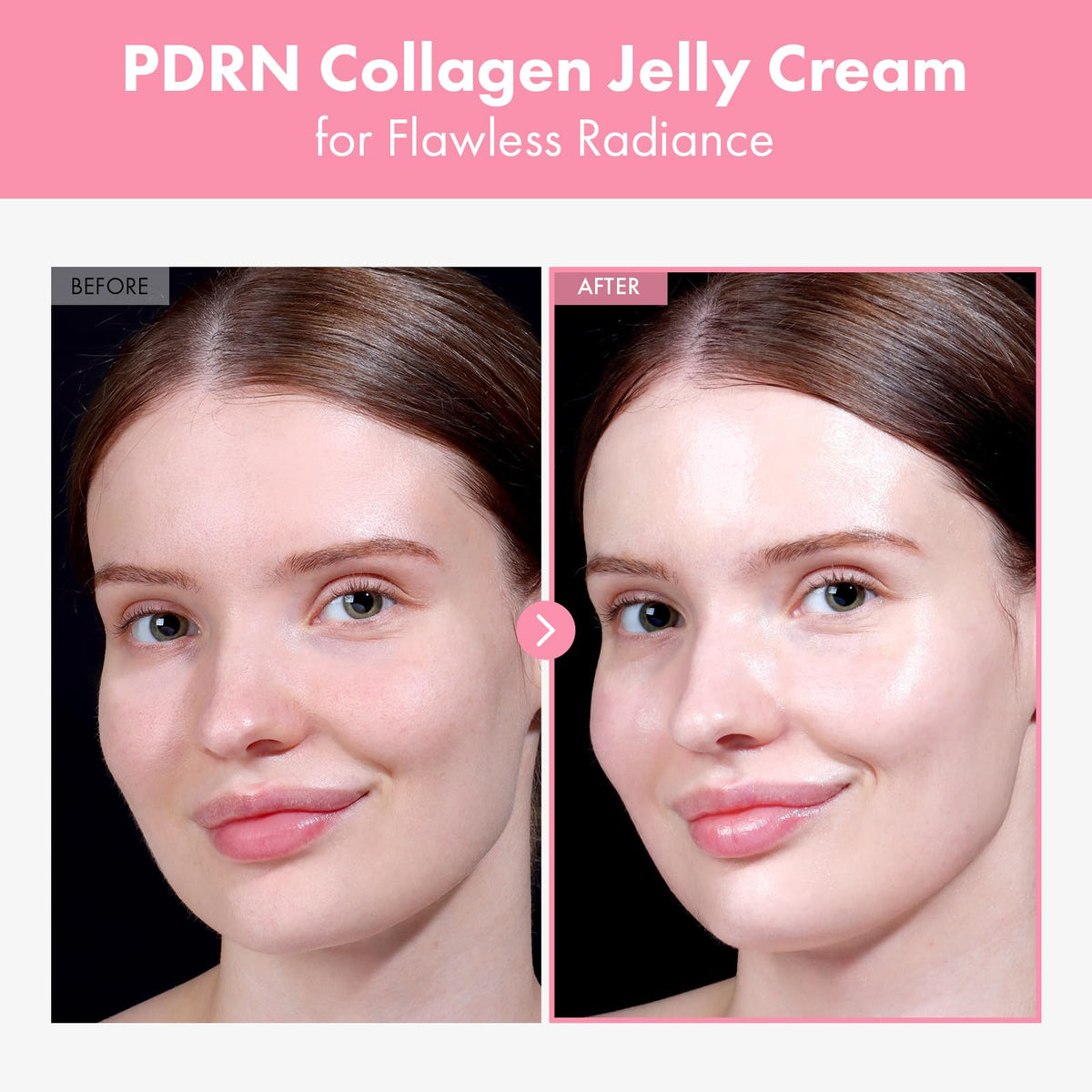 TOSOWOONG PDRN Collagen Jelly Cream, 5,000ppm Salmon DNA PDRN, Niacinamide - FENGGESTORE20