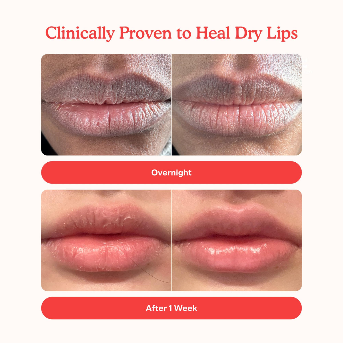 Tower 28 LipSoftie Tinted Lip Balm Treatment - Hydrating Glossy Balm + Overnight Lip Mask with Jojoba Oil + Shea Butter - Sweet, Cushiony Formula for Smooth, Soft Lips - Watermelon Kiwi (0.38 oz) - FENGGESTORE20