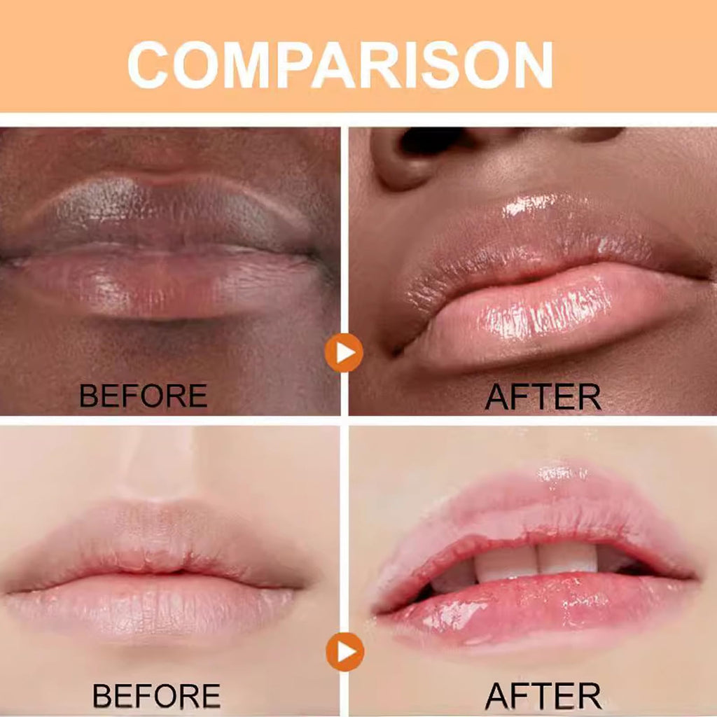 Turmeric Lip Balm for Smokers With Root Oil - Brightening for Dark Lips, Long-Lasting Moisturizer for Dry - FENGGESTORE20