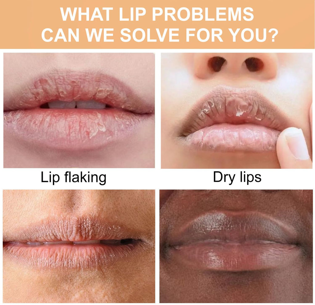 Turmeric Lip Balm for Smokers With Root Oil - Brightening for Dark Lips, Long-Lasting Moisturizer for Dry - FENGGESTORE20