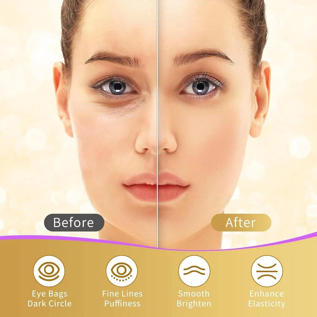 Under Eye Patches, 40 Pairs Eye Mask for Dark Circles, Puffy Eyes, Undereye Bags,Wrinkles - FENGGESTORE20