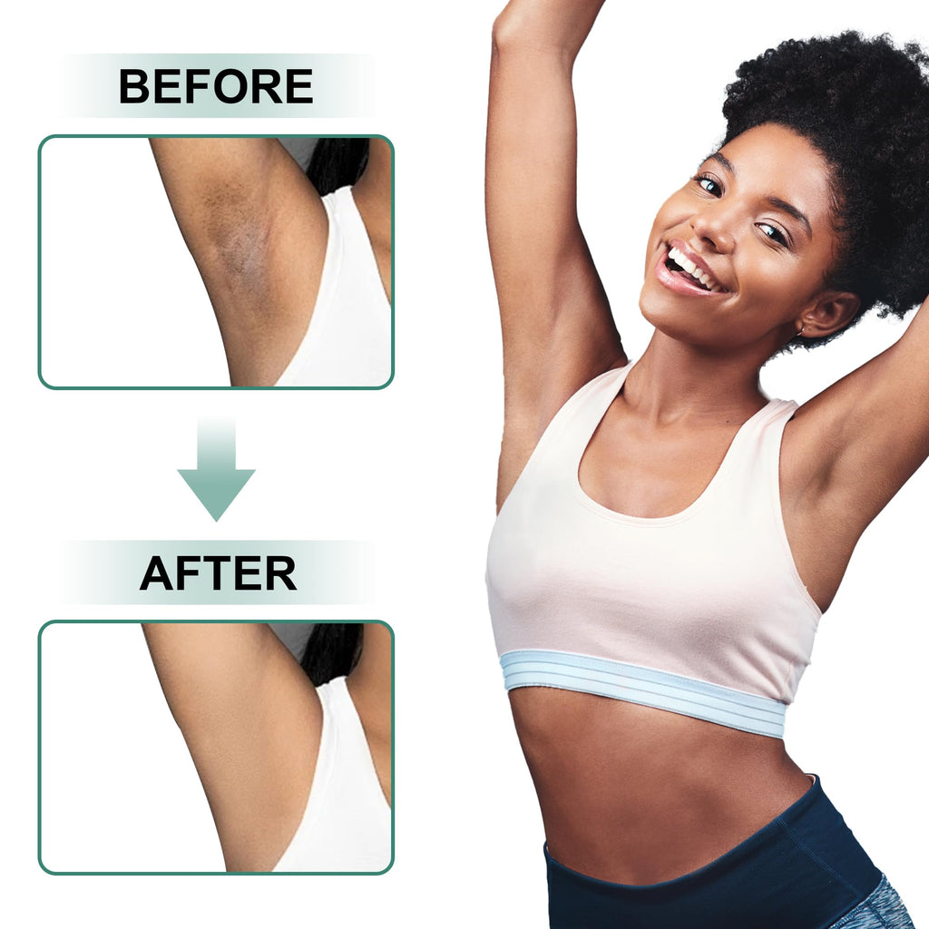 Vcetree Skin Bleaching Cream Skin Lightening for Body Intimate Areas, Private Parts, Underarm, Knees, Elbows, Inner Thigh, Bikini Area - FENGGESTORE20