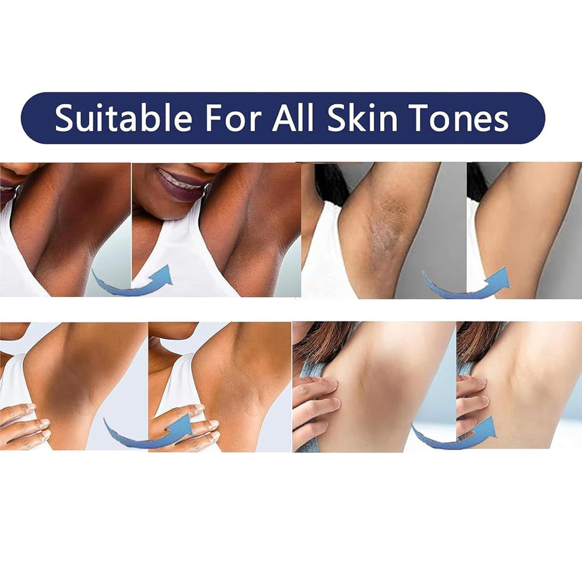 Vcetree Skin Bleaching Cream Skin Lightening for Body Intimate Areas, Private Parts, Underarm, Knees, Elbows, Inner Thigh, Bikini Area - FENGGESTORE20