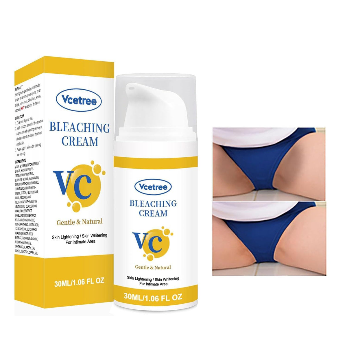Vcetree Skin Bleaching Cream Skin Lightening for Body Intimate Areas, Private Parts, Underarm, Knees, Elbows, Inner Thigh, Bikini Area - FENGGESTORE20