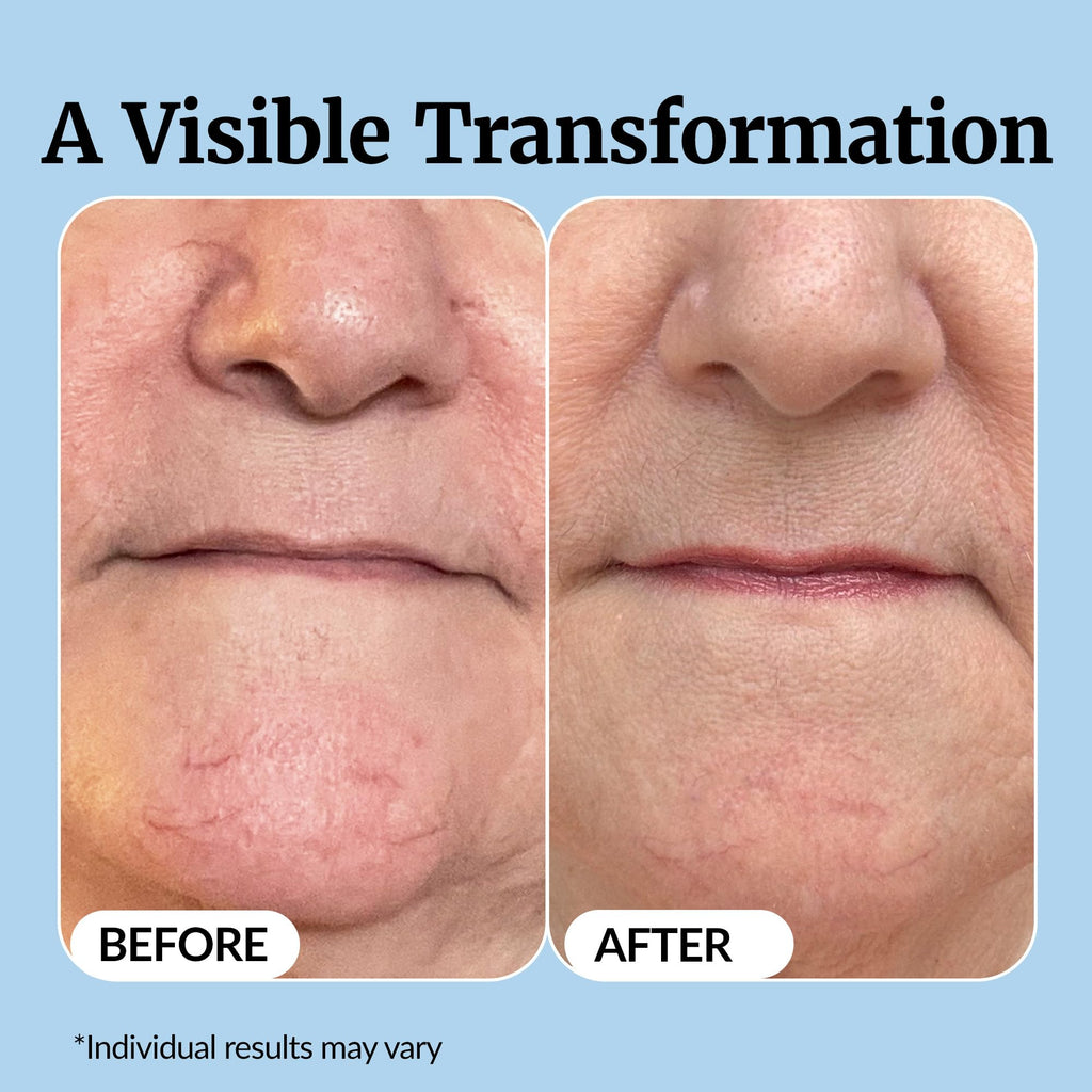 Vibriance Super C Serum for Mature Skin - All-in-One Vitamin Formula Hydrates, Firms, Lifts, Smooths, Targets Age Spots, Wrinkles, 1 fl oz - Pack of 3 - FENGGESTORE20