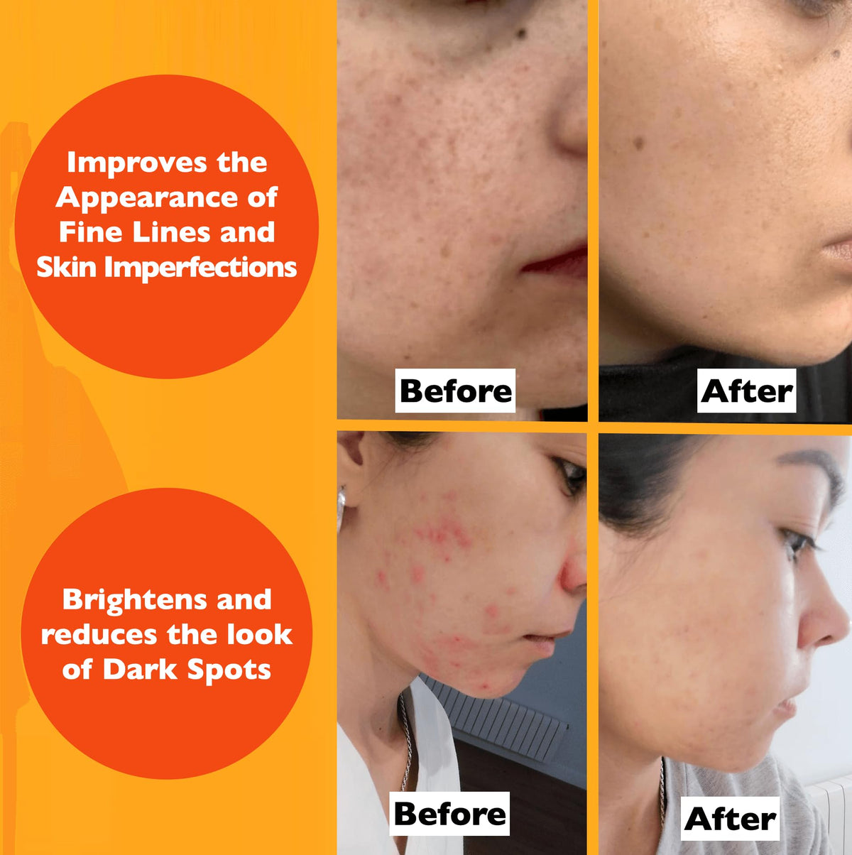 Vitamin C Serum For Face – Anti Aging Face Serum with Vitamin C, Hyaluronic Acid, Vitamin E. Brightening Formula. Improve Appearance of Dark Spots, - FENGGESTORE20