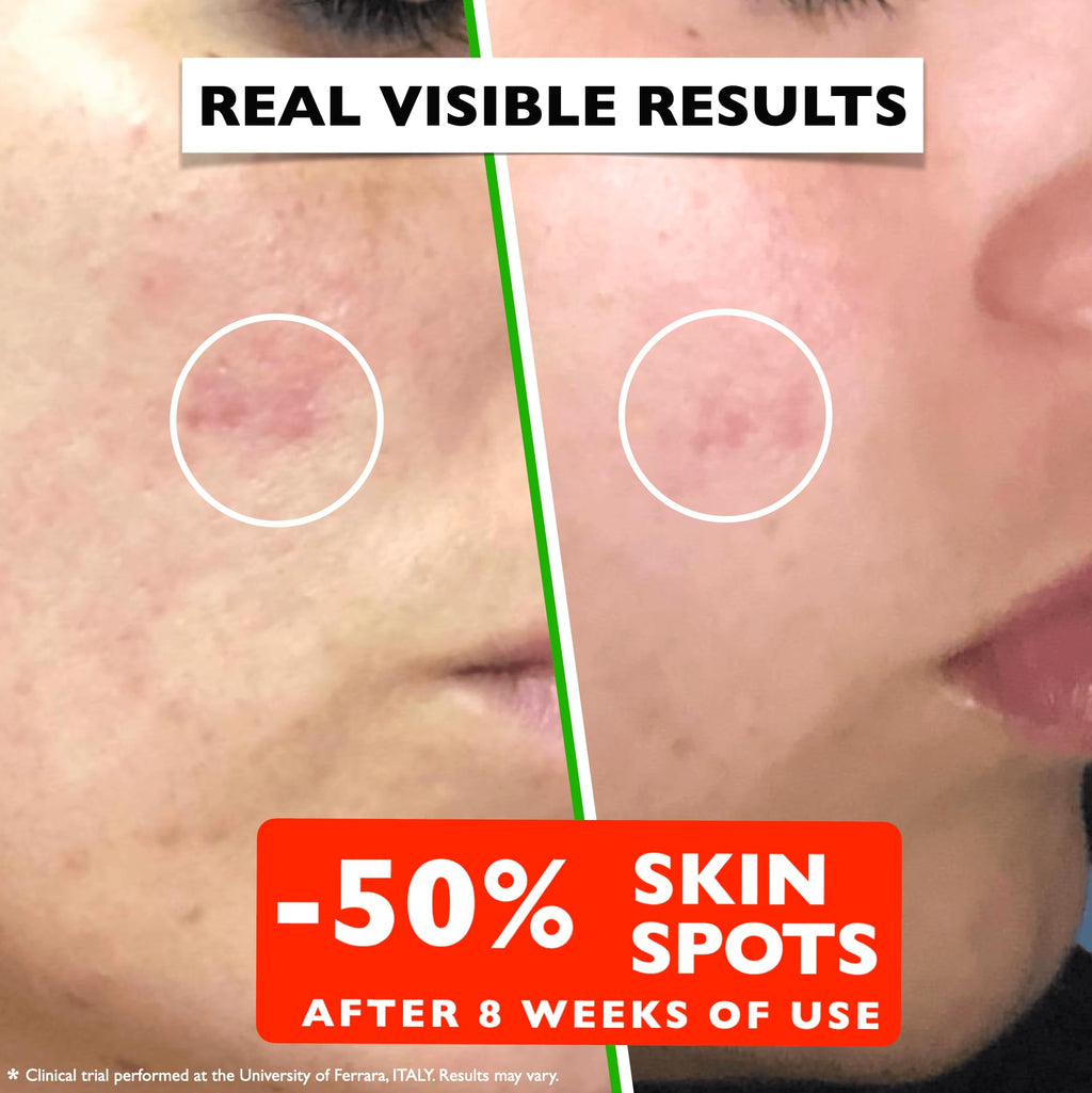 Vitamin C Serum For Face – Anti Aging Face Serum with Vitamin C, Hyaluronic Acid, Vitamin E. Brightening Formula. Improve Appearance of Dark Spots, - FENGGESTORE20