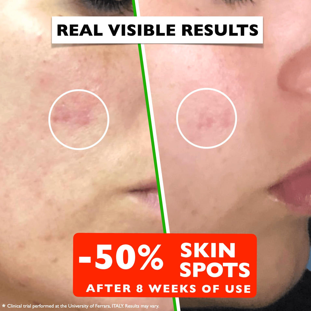 Vitamin C Serum For Face – Anti Aging Face Serum with Vitamin C, Hyaluronic Acid, Vitamin E. Brightening Formula. Improve Appearance of Dark Spots, - FENGGESTORE20