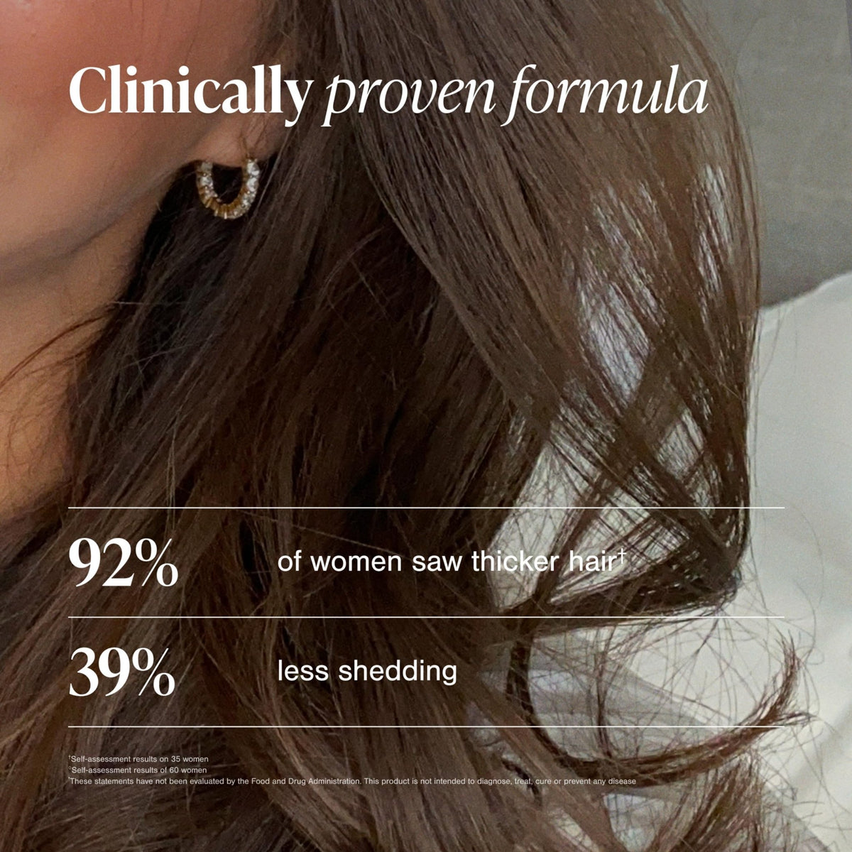 Viviscal Hair Growth Supplements For Women For Thicker, Fuller Hair, Nourishes Thinning & Loss, With Proprietary Collagen Complex, - FENGGESTORE20