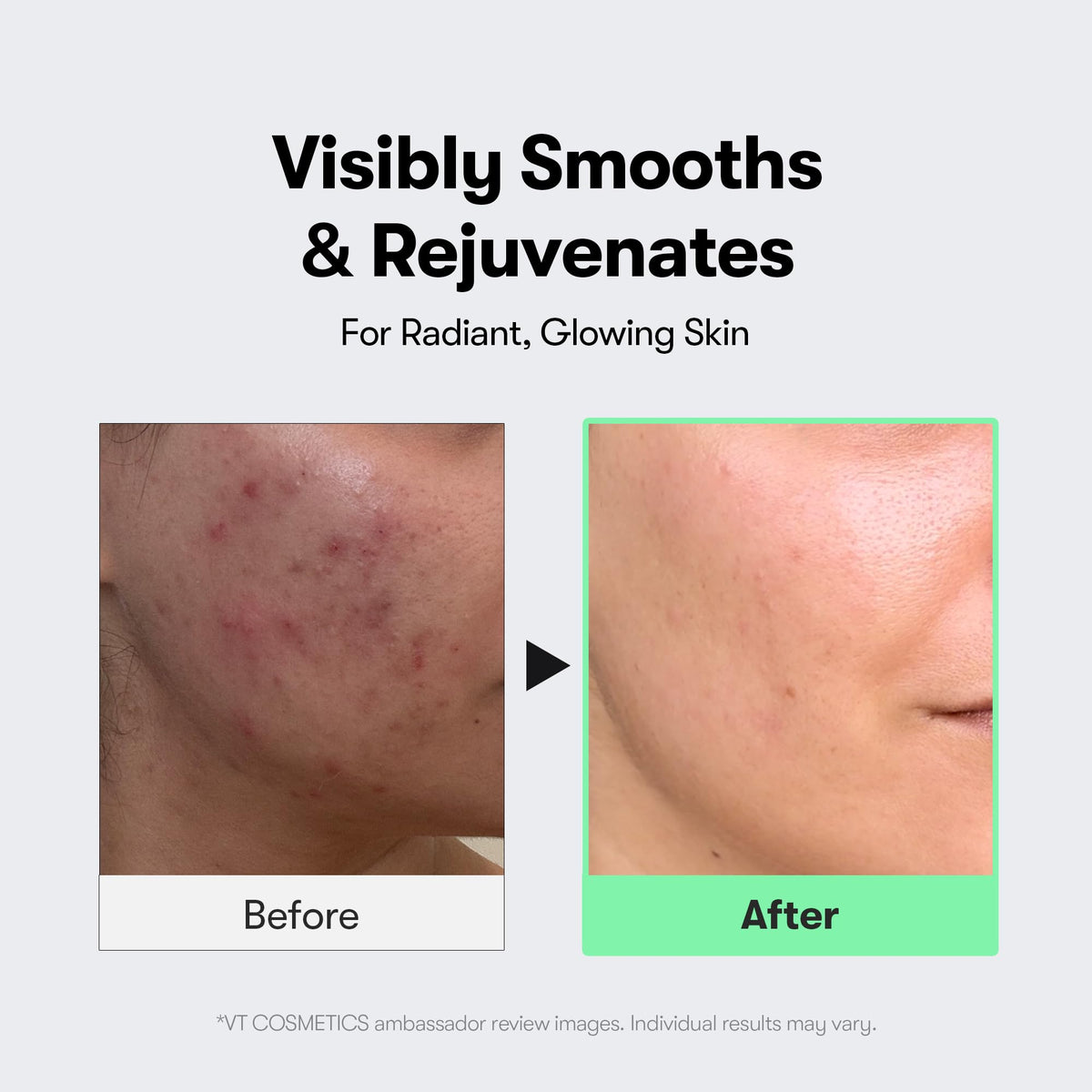 VT COSMETICS CICA Reedle Shot 100, Spicule Microneedling Serum for Pore Care & Exfoliation, Exosome, Centella Asiatica for Glass Skin - FENGGESTORE20