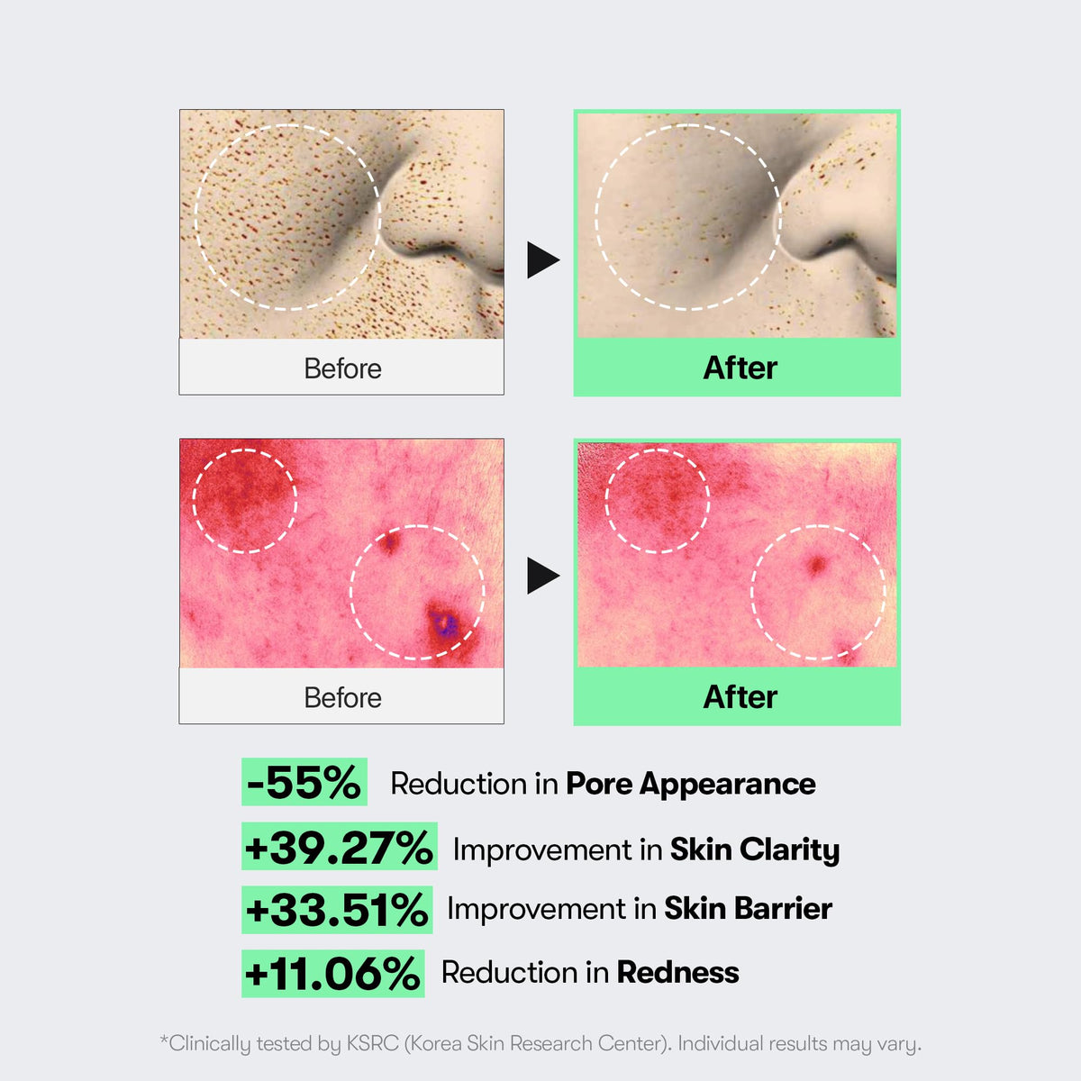 VT COSMETICS CICA Reedle Shot 100, Spicule Microneedling Serum for Pore Care & Exfoliation, Exosome, Centella Asiatica for Glass Skin - FENGGESTORE20